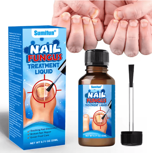 Nail Fungus Liquid – Care Solution | علاج فطريات الأظافر